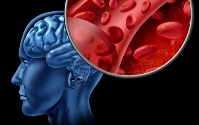 Carence en oxygène du cerveau