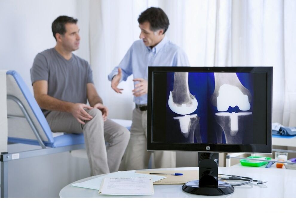 arthrose de l'articulation du genou dans l'image x-ray